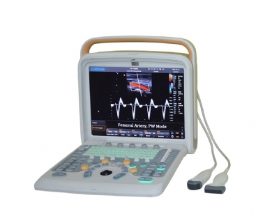 Máy siêu âm thú y 2d doppler màu q5 vet