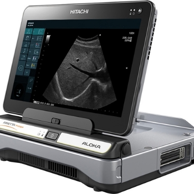 Máy siêu âm doppler màu xách tay prologue